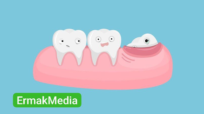 Сэкономили на мудрости 