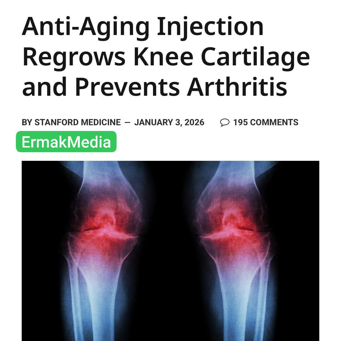 Новые суставы 