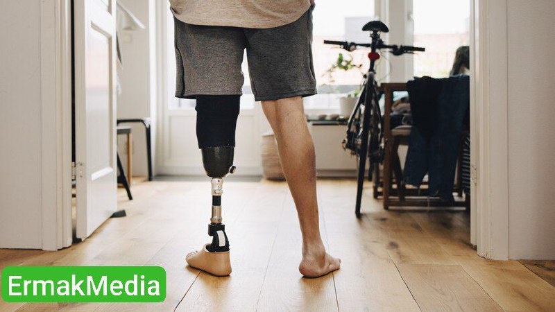 Минтруд прогнозирует повышение спроса на протезы